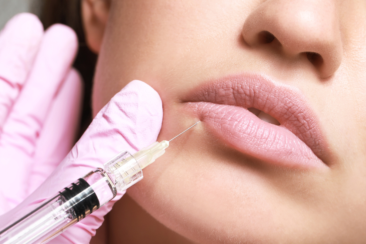 Young Woman Receiving Injection of Filler in Lips, Closeup